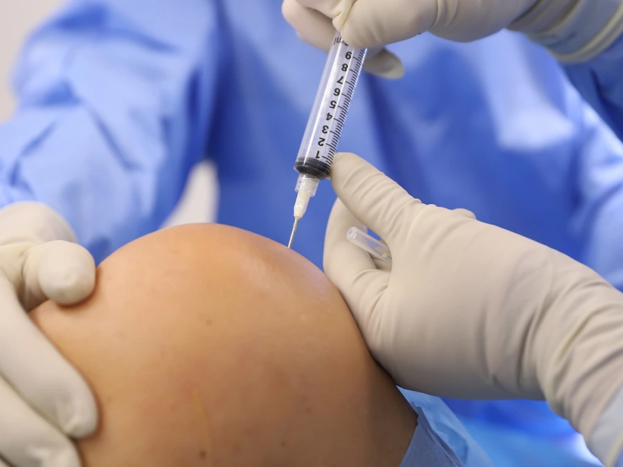 Medico esegue un’infiltrazione di cellule staminali da midollo osseo per trattamento ortopedico