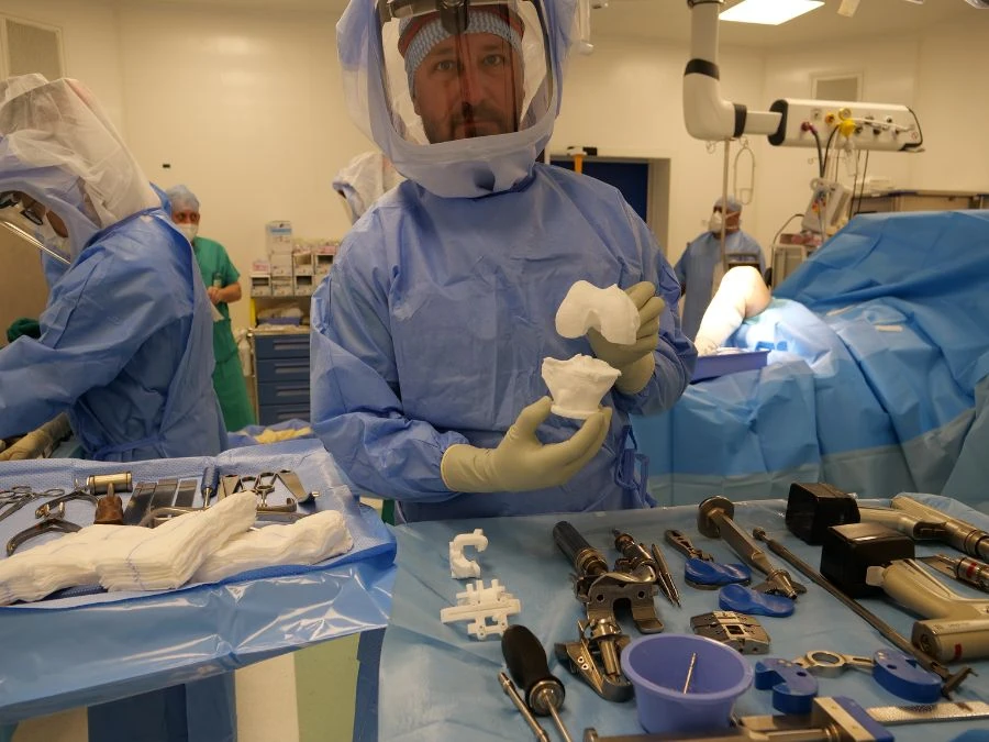 Modello 3D di ginocchio con protesi My Knee su misura per pazienti con deformità o artrosi avanzata