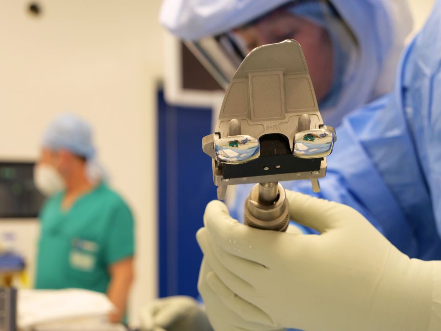 Chirurgo prepara un impianto protesico personalizzato per ginocchio o anca.