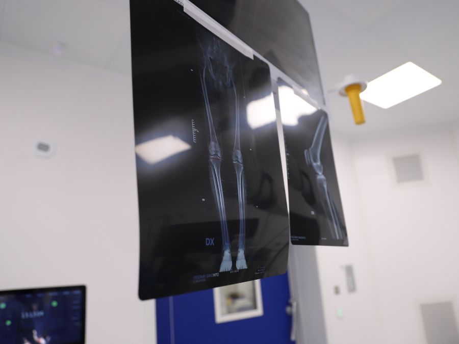 Chirurgo esamina immagini TAC per progettare una protesi custom-made su misura del paziente