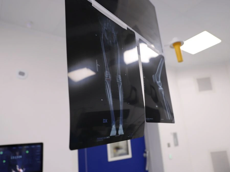 Chirurgo esamina immagini TAC per progettare una protesi custom-made su misura del paziente