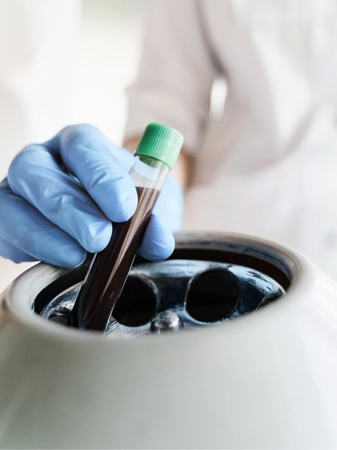 PRP plasma ricco di piastrine per il trattamento rigenerativo del ginocchio